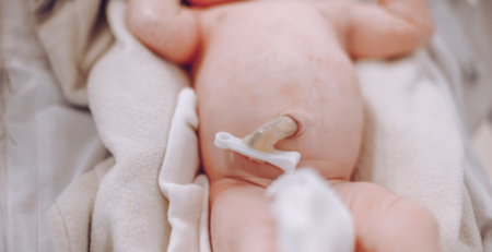Sangue do cordão umbilical expandido em laboratório com potencial para curar anemia falciforme