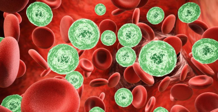 Aumento do risco de infecções no mieloma múltiplo assintomático: resultados do estudo iStopMM