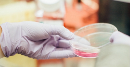 Terapias de imuno-oncologia produzem avanços em cancro ginecológico