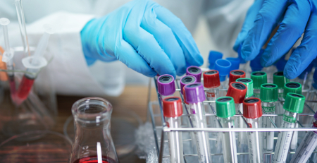 Investigadores do i3S pretendem melhorar sobrevivência de doentes com leucemia mieloide aguda