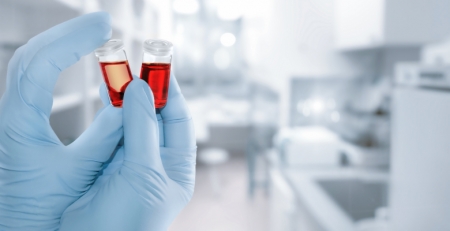 Impacto de fármacos inovadores no tratamento da hemofilia
