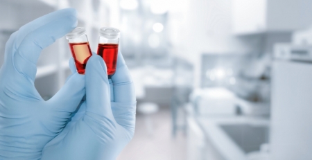 Leucemia: descoberto mecanismo que pode aumentar a eficiência da quimioterapia
