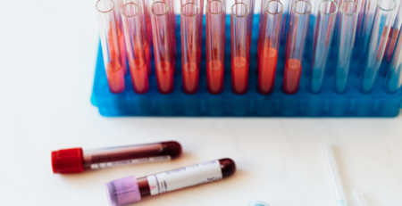Peritos portugueses pedem incentivos à doação de plasma
