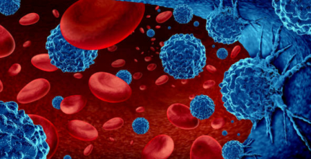Nova opção terapêutica para o mieloma múltiplo: daratumumab financiado em Portugal