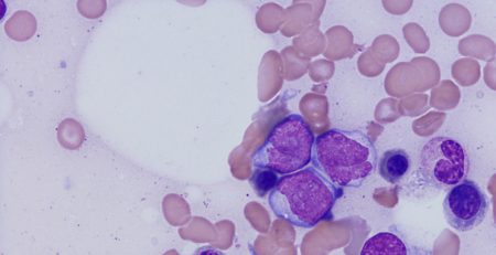 Fundação Champalimaud organiza colóquio sobre "Niche Remodeling and Iron Metabolism in Acute Myeloid Leukemia"