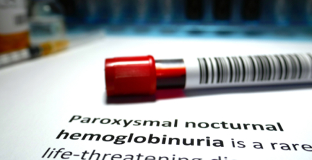 EMA recomenda primeira terapêutica oral para doentes com hemoglobinúria paroxística noturna