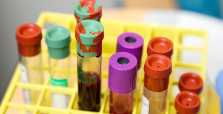 Estudo diz que pessoas com o tipo de sangue A estão mais vulneráveis à COVID-19