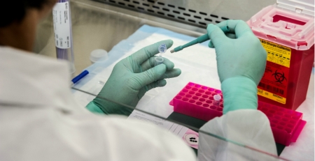 Autorizado polatuzumab vedotina da Roche para pessoas com linfoma difuso de grandes células B previamente tratado