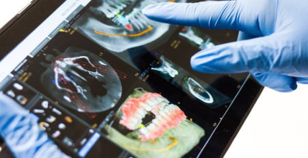 Estudo demonstrou que a taxa de colonização oral por bacilos gram-negativos é duas vezes superior em doentes hemato-oncológicos