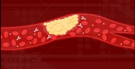 Identificada nova causa para a coagulação nos doentes COVID-19