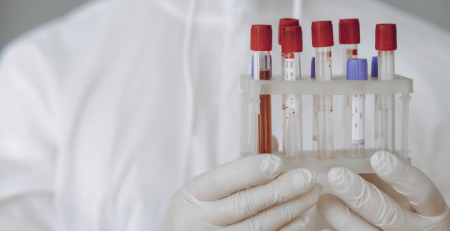 Isatuximab recebe aprovação de financiamento do Infarmed para tratamento do mieloma múltiplo recidivante e refratário
