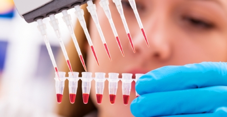 Transplante de células estaminais hematopoieticas autólogas modificadas por CRISPR-Cas9 elimina a necessidade de transfusão em doentes com β-talassemia dependente de transfusão ou com depranocitose