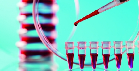 LLC R/R: venetoclax em associação com rituximab revela resultados promissores