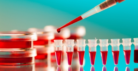 Novos dados apresentados no tratamento de telangiectasia hemorrágica hereditária