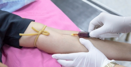 Plasma de pessoas recuperadas da COVID-19 é ineficaz no tratamento de doentes