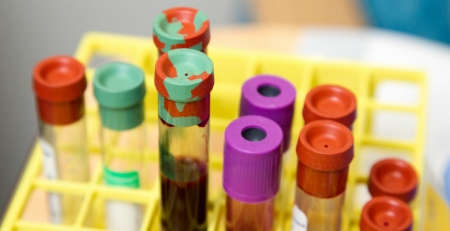 Instituto Português do Sangue e Transplantação cria plano de contingência para colheita de sangue