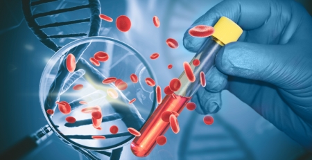 Ensaio US MM-6 mostra benefícios de inibidores de proteossoma na vida real